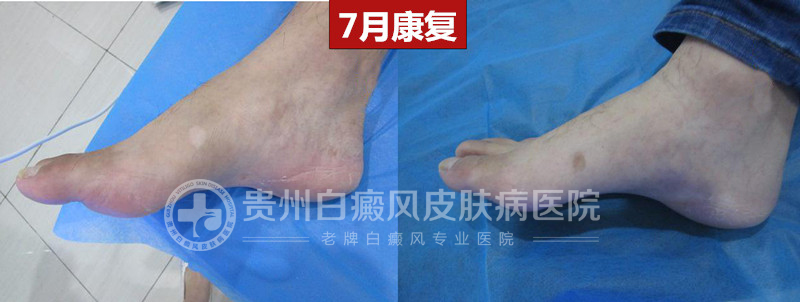 ��ĳ  34��  ɢ����  ��չ�ڰ���20����