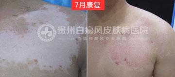 ��ĳ �ಿλ �ڶ���-��չ�ڰ��� 18����